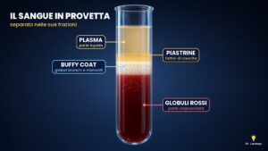 Infiltrazioni con monociti a Lainate: cosa sono e come si svolgono